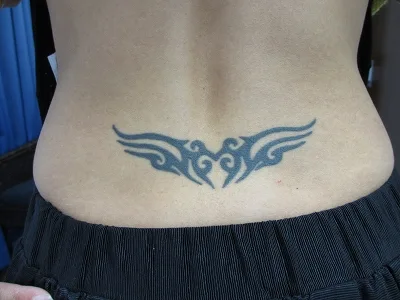 タトゥー（刺青）除去の術前