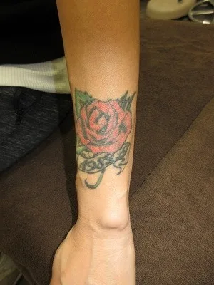 タトゥー（刺青）除去の術前