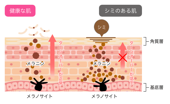 ターンオーバー