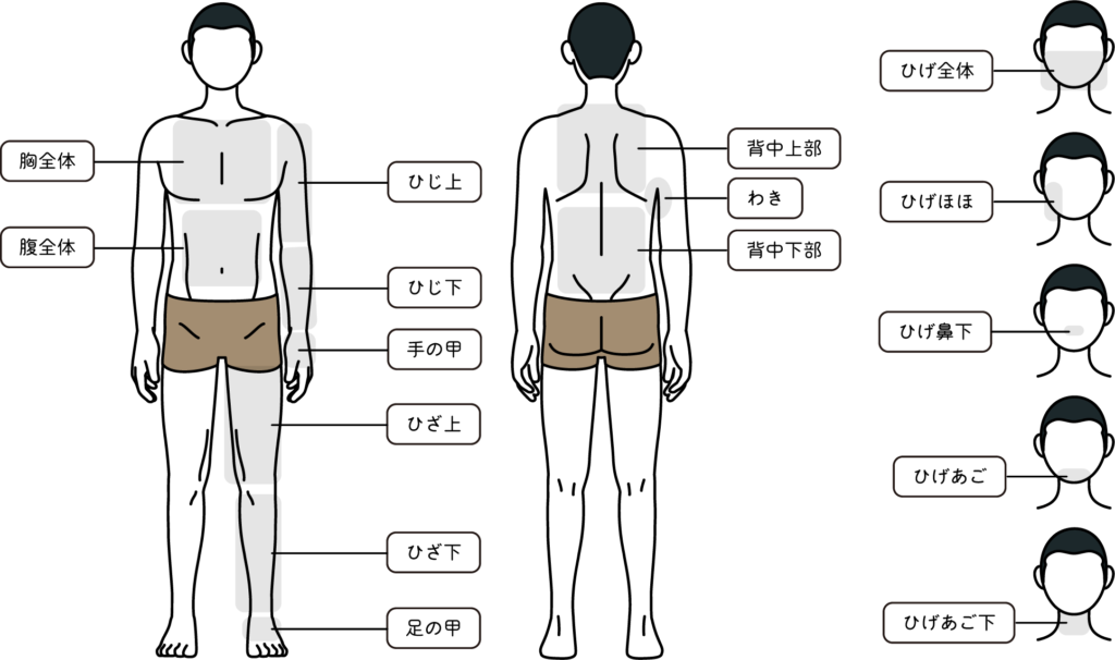 鶴見区のメンズ全身医療脱毛対象部位