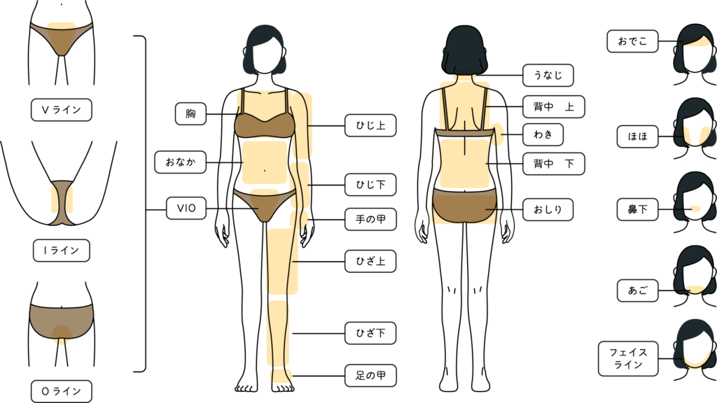鶴見区の女性医療脱毛対象部位