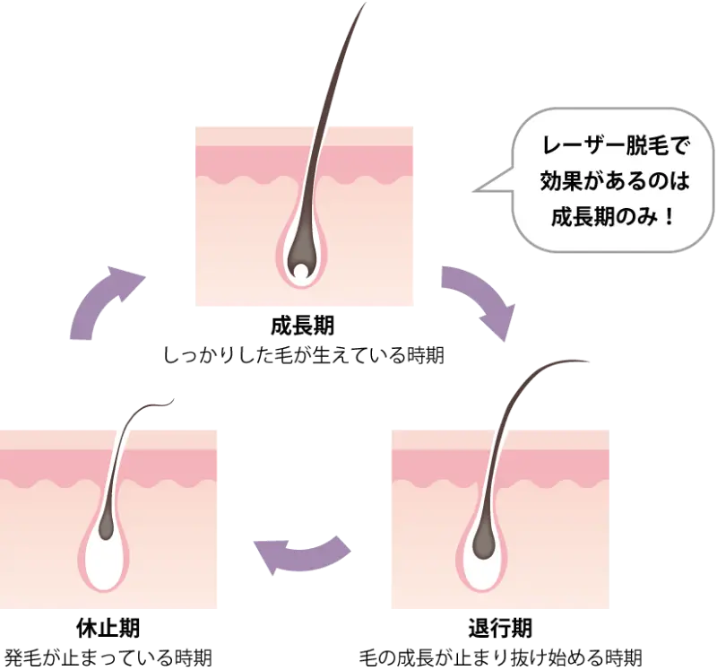三輪皮フ科形成外科のジェントルマックスプロプラスのヤグレーザー